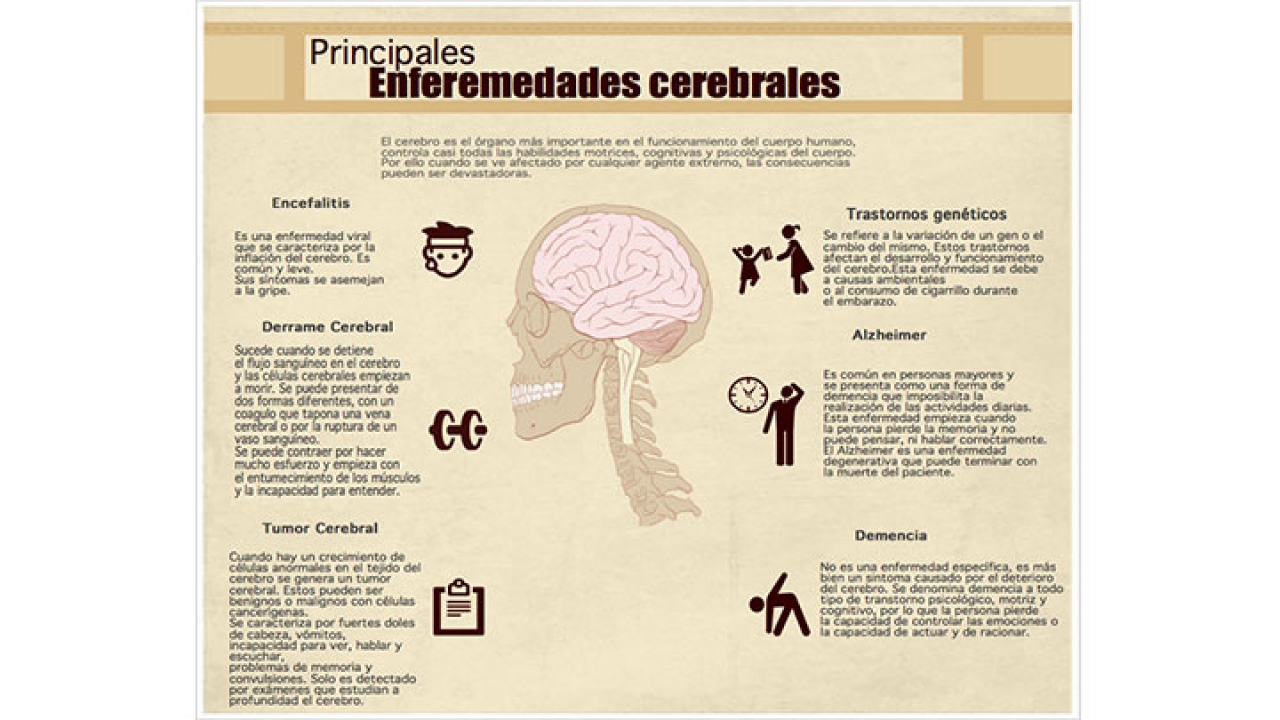 Infografía cerebro|||