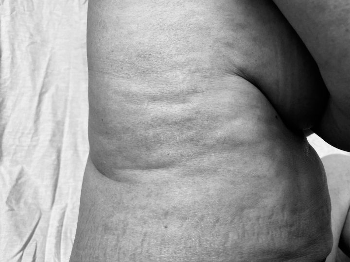 Mi cuerpo me&hellip; &iquest;repugna?