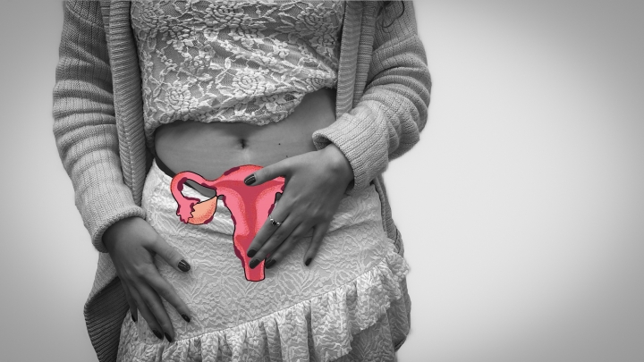 Cuando el dolor no se ve: mujeres que viven con endometriosis