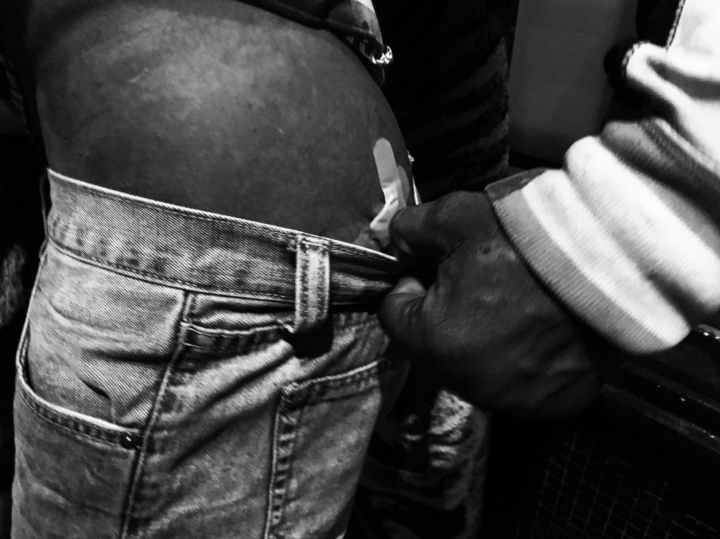 Herida de pu&ntilde;alada en el trasero de Faber tras una pelea callejera