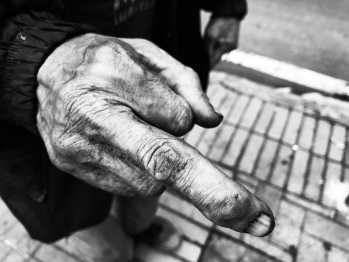 Mano de Pedro, mordida por un rat&oacute;n