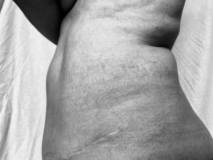 Mi cuerpo me&hellip; &iquest;repugna?