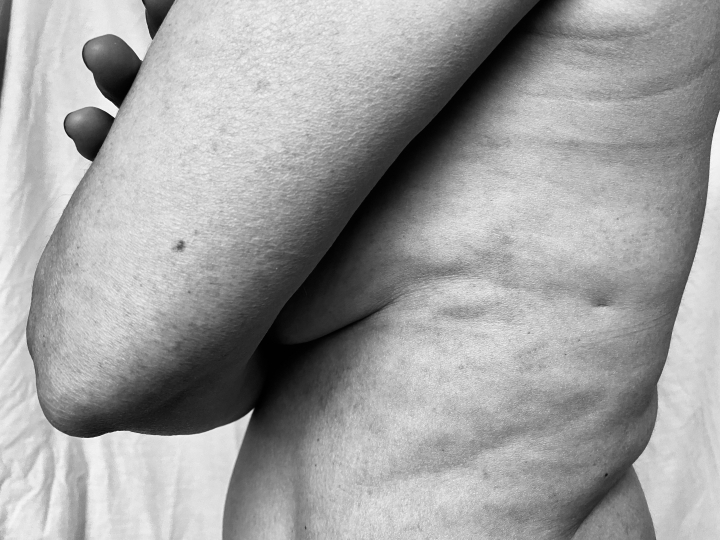 Mi cuerpo me&hellip; &iquest;repugna?