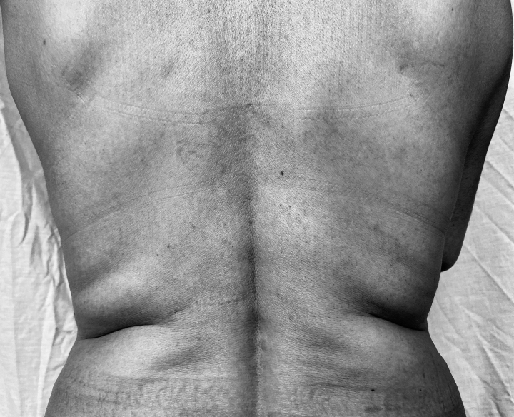 Mi cuerpo me&hellip; &iquest;repugna?