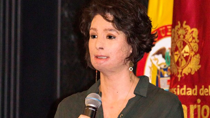 Rosario firma convenio para asistir a v&iacute;ctimas de ataques con &aacute;cido