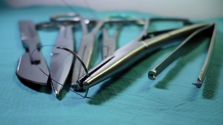 S&iacute;ndrome de ASIA, la enfermedad qu&eacute; esta haciendo que mujeres en todo el mundo se quiten sus implantes mamarios.